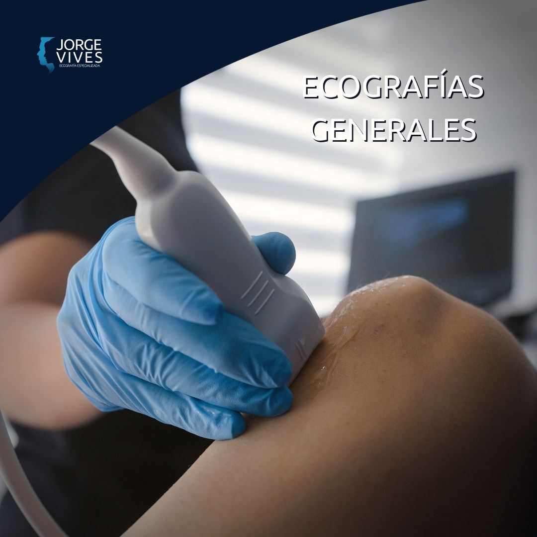Ecografías Generales