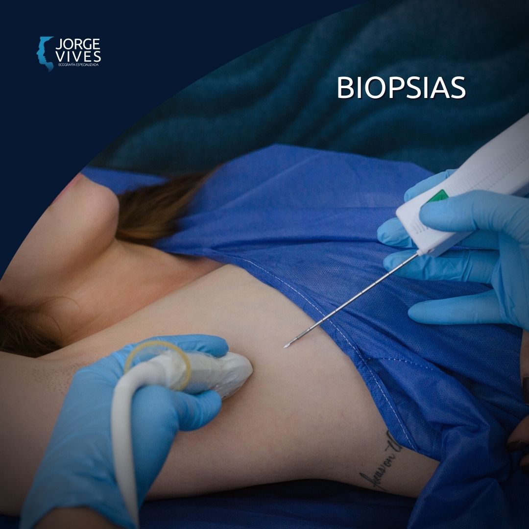 Biopsias