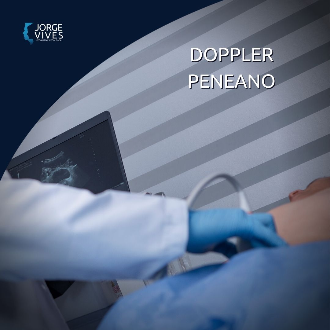 Doppler