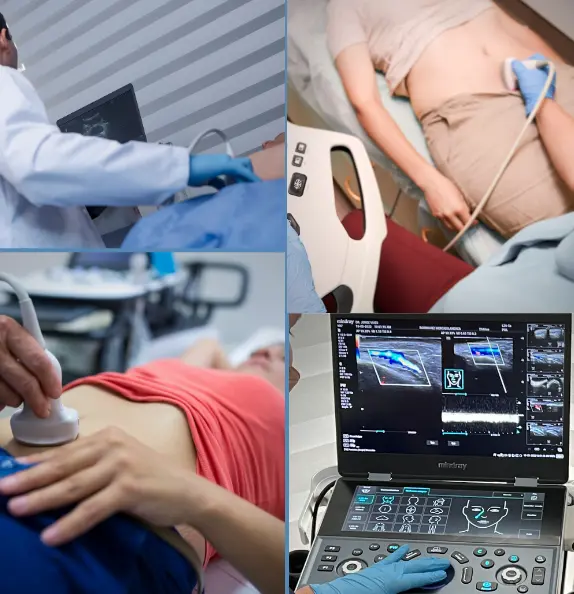 Ecografía mamaria en Cartagena con el Dr. Jorge Vives, radiólogo