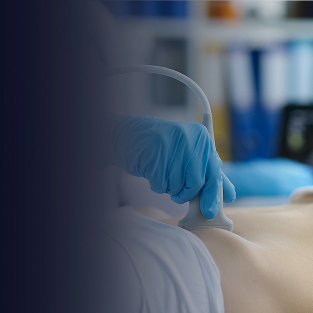 Ecografía de vías urinarias en Cartagena: imagen renal por ultrasonido