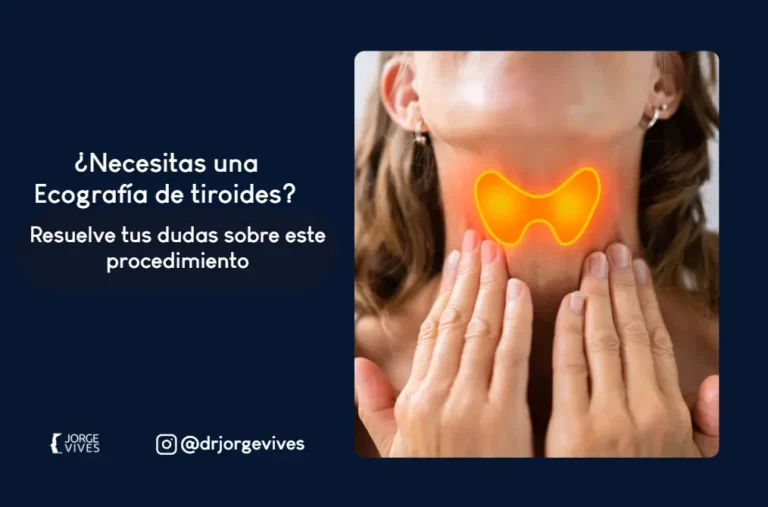 Ecografía de tiroides en Cartagena-Dr. Jorge Vives Ecografias