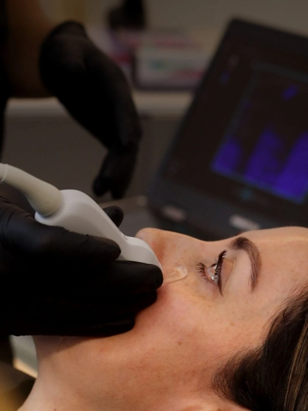 Curso de ecografía facial presencial - Dr. Jorge Vives - Médico Estético y Médico Radiólogo en Cartagena