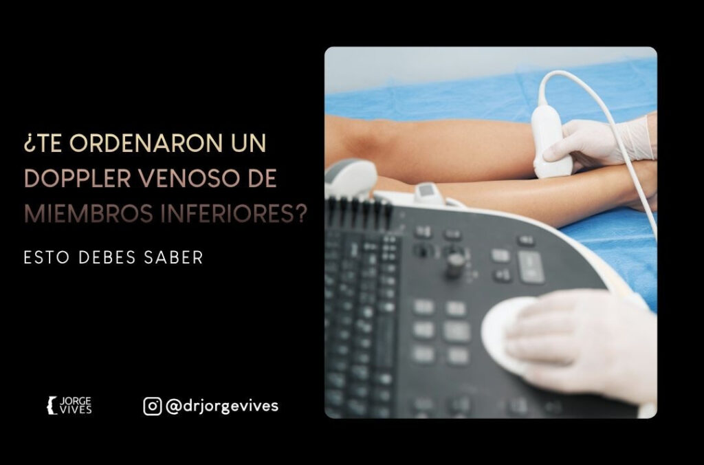 Te ordenaron un Doppler venoso de miembros inferiores Esto debes saber - Dr Jorge Vives Ecografias